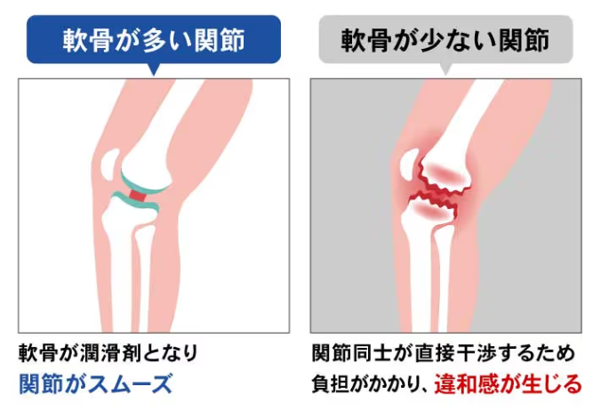 左が軟骨クッションあり、右がなし