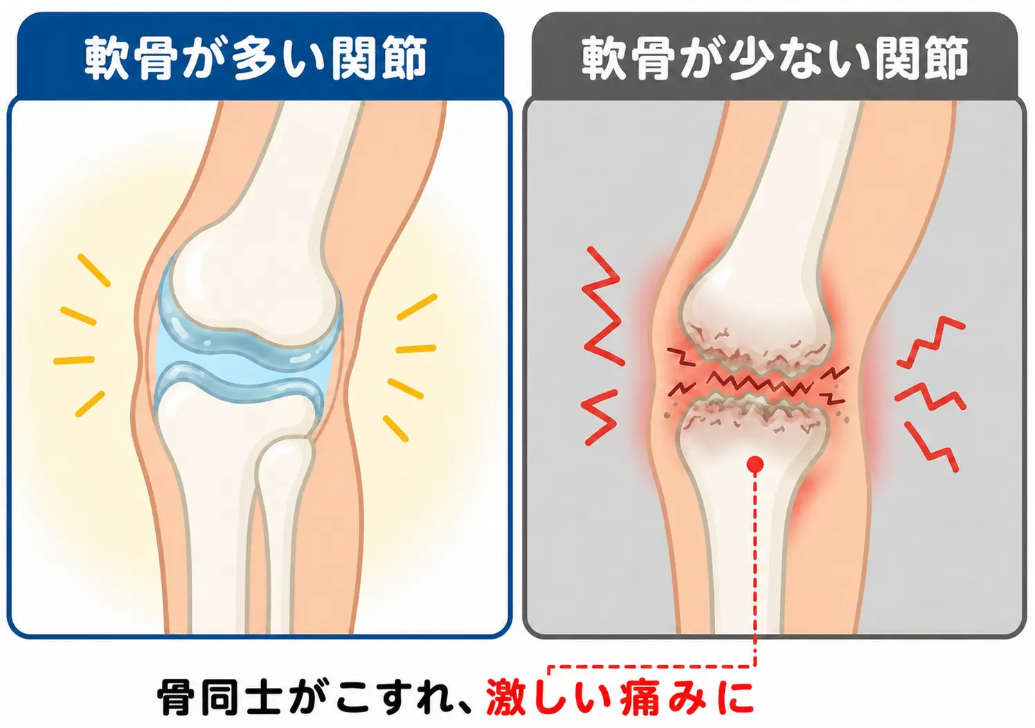 関節が直接こすれ、痛み